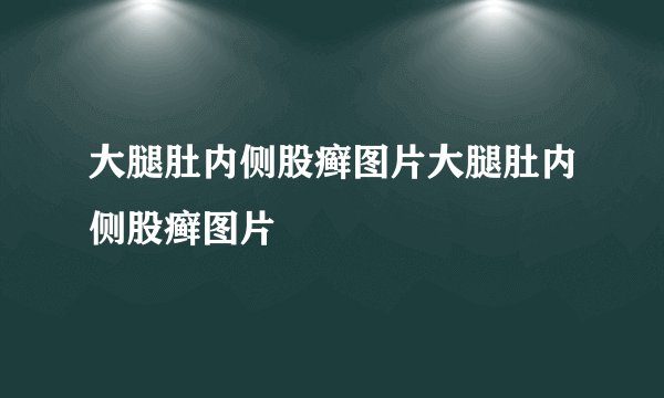 大腿肚内侧股癣图片大腿肚内侧股癣图片