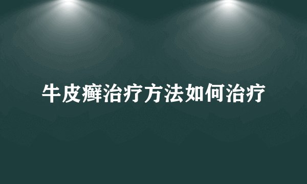 牛皮癣治疗方法如何治疗