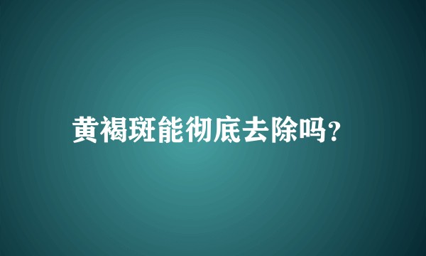 黄褐斑能彻底去除吗？
