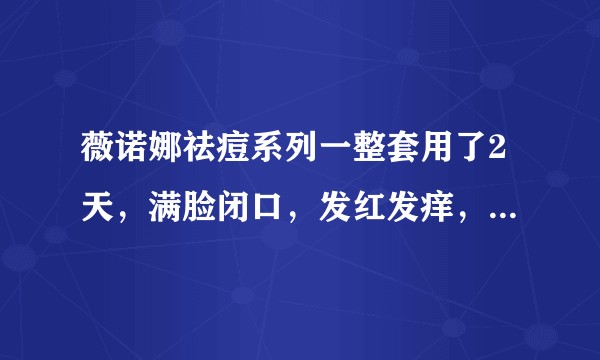 薇诺娜祛痘系列一整套用了2天，满脸闭口，发红发痒，是不合适吗？