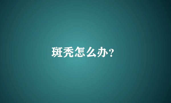 斑秃怎么办？